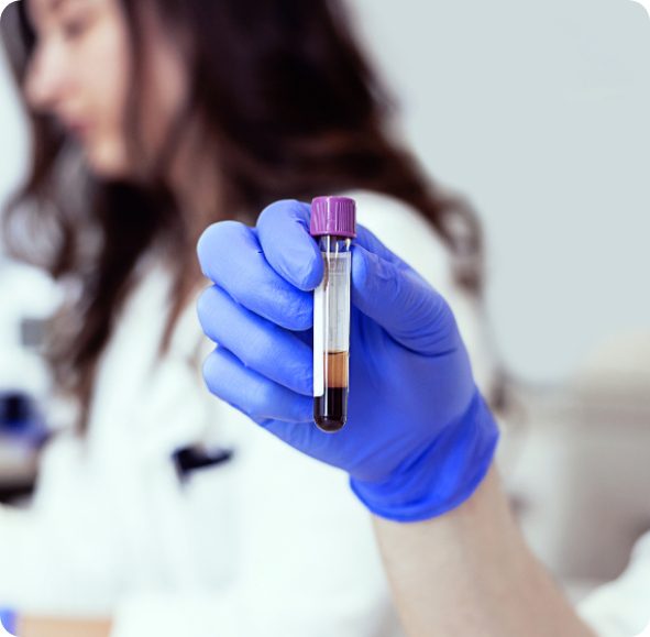 closeup of a hand holding a test tube with separated blood and plasma